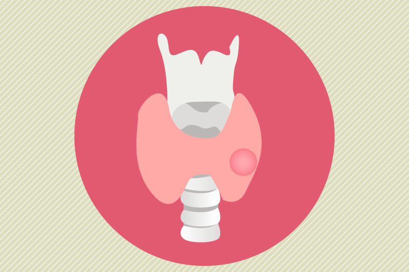 Management-of-Atypical-Thyroid-Nodules-1